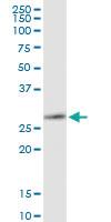 Anti-MMP7 Polyclonal Antibody Pair