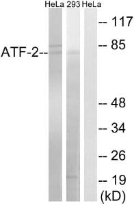 Anti-ATF-2 antibody