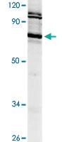 Anti-PRKCD Rabbit Polyclonal Antibody