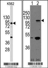 Anti-CDH3 Rabbit Polyclonal Antibody (AP (Alkaline Phosphatase))