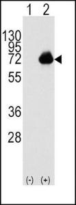 Anti-ACOX1 Rabbit Polyclonal Antibody (AP (Alkaline Phosphatase))