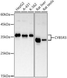 Western blot analysis of extracts of various cell lines, using Anti-CYB5R3 Antibody [ARC2849] (A307340) at 1:1,000 dilution. The secondary antibody was Goat Anti-Rabbit IgG H&L Antibody (HRP) at 1:10,000 dilution.