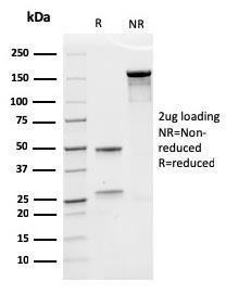 SDS-PAGE analysis of Anti-EPO Antibody [rEPO/1367] under non-reduced and reduced conditions; showing intact IgG and intact heavy and light chains, respectively. SDS-PAGE analysis confirms the integrity and purity of the Antibody