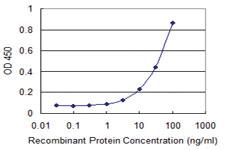 Anti-ZKSCAN1 Mouse Monoclonal Antibody [clone: 2C7]