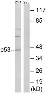 Western blot analysis of lysates from 293 cells using Anti-p53 Antibody. The right hand lane represents a negative control, where the antibody is blocked by the immunising peptide