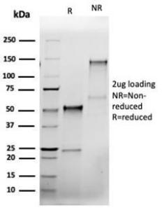 SDS-PAGE analysis of Anti-Bcl-X Antibody [rBCL2L1/4508] under non-reduced and reduced conditions; showing intact IgG and intact heavy and light chains, respectively SDS-PAGE analysis confirms the integrity and purity of the antibody