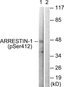 Western blot analysis of lysates from COS7 cells treated with Etoposide 25uM 60' using Anti-Arrestin 1 (phospho Ser412) Antibody. The right hand lane represents a negative control, where the antibody is blocked by the immunising peptide