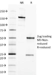 SDS-PAGE analysis of Anti-EpCAM Antibody [EGP40/1798] under non-reduced and reduced conditions; showing intact IgG and intact heavy and light chains, respectively. SDS-PAGE analysis confirms the integrity and purity of the antibody