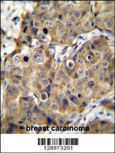 Anti-TMEM100 Rabbit Polyclonal Antibody (FITC (Fluorescein Isothiocyanate))