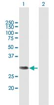 Anti-NSMCE2 Mouse Polyclonal Antibody