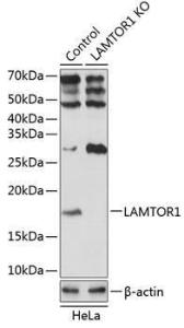 Anti-LAMTOR1 Rabbit Polyclonal Antibody