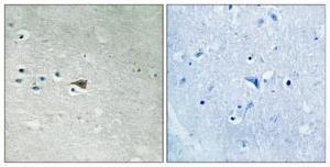 Immunohistochemical analysis of paraffin-embedded human brain using Anti-Arrestin 1 (phospho Ser412) Antibody 1:100 (4 °C overnight). The right hand panel represents a negative control, where the antibody was pre-incubated with the immunising peptide