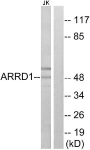 Western blot analysis of lysates from Jurkat cells using Anti-ARRD1 Antibody. The right hand lane represents a negative control, where the antibody is blocked by the immunising peptide.