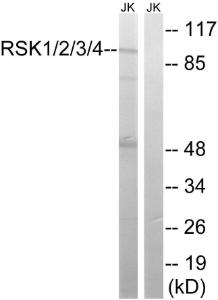 Anti-RSK1 and RSK2 and RSK3 and RSK4 antibody