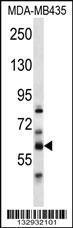 Anti-PTDSS2 Rabbit Polyclonal Antibody