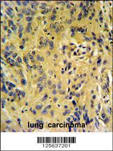 Anti-TESC Rabbit Polyclonal Antibody (FITC (Fluorescein Isothiocyanate))