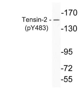 Western blot analysis of lysate from K562 cells using Anti-Tensin-2 (phospho Tyr483) Antibody