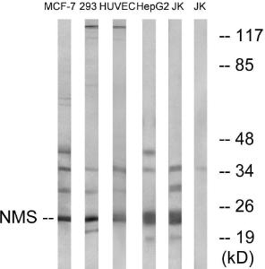 Anti-NMS Rabbit Polyclonal Antibody