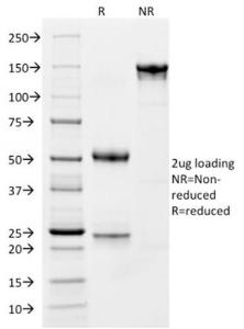 SDS-PAGE analysis of Anti-CD163 Antibody [M130/1210] under non-reduced and reduced conditions; showing intact IgG and intact heavy and light chains, respectively. SDS-PAGE analysis confirms the integrity and purity of the antibody.