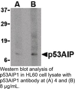 Anti-P53AIP1 Rabbit Polyclonal Antibody