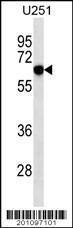 Anti-RYK Mouse Monoclonal Antibody [clone: 240CT2.2.4]