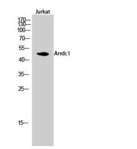 Western blot analysis of Jurkat cells using Anti-ARRD1 Antibody