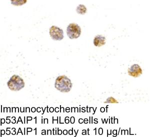 Anti-P53AIP1 Rabbit Polyclonal Antibody