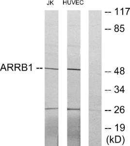 Anti-pan Arrestin Rabbit Polyclonal Antibody