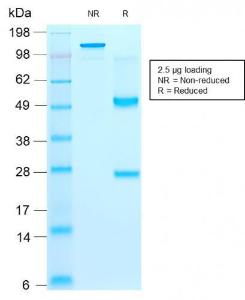 SDS-PAGE analysis of Anti-CD44v9 Antibody [rCD44v9/1459] under non-reduced and reduced conditions; showing intact IgG and intact heavy and light chains, respectively. SDS-PAGE analysis confirms the integrity and purity of the antibody.