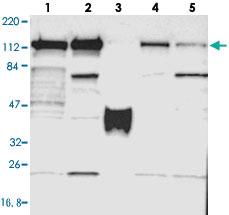 Anti-PPFIBP1 Rabbit Polyclonal Antibody