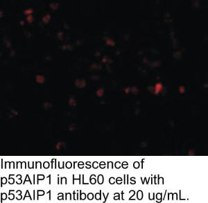 Anti-P53AIP1 Rabbit Polyclonal Antibody