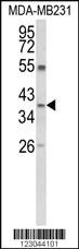 Anti-ARG1 Rabbit Polyclonal Antibody