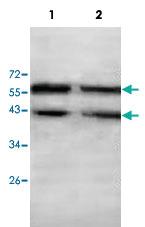 Anti-SMAD2 Rabbit Polyclonal Antibody