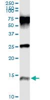 Anti-PI3 Mouse Monoclonal Antibody