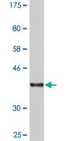 Anti-RABEP1 Mouse Monoclonal Antibody [clone: 3H6]