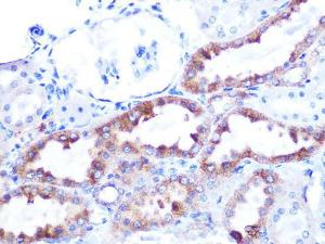 Immunohistochemistry analysis of paraffin-embedded rat kidney using Anti-Cytochrome C Antibody [ARC1153] (A307346) at a dilution of 1:100 (40x lens). Perform microwave antigen retrieval with 10 mM PBS buffer pH 7.2 before commencing with IHC staining protocol.