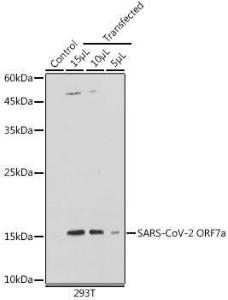 Western blot analysis of extracts of normal 293T cells and 293T transfected with ORF7a Protein, using Anti-SARS-CoV-2 ORF7a Antibody (A305756) at 1:1,000 dilution