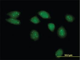 Anti-NSMCE2 Mouse Polyclonal Antibody