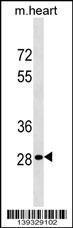 Anti-HOXB13 Rabbit Polyclonal Antibody (AP (Alkaline Phosphatase))