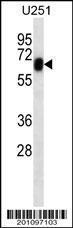 Anti-RYK Mouse Monoclonal Antibody (AP (Alkaline Phosphatase)) [clone: 240CT2.2.4]