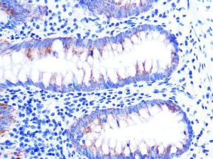 Immunohistochemistry analysis of paraffin-embedded human appendix tissue using Anti-Cytochrome C Antibody [ARC1153] (A307346) at a dilution of 1:100 (40x lens). Perform microwave antigen retrieval with 10 mM PBS buffer pH 7.2 before commencing with IHC staining protocol.