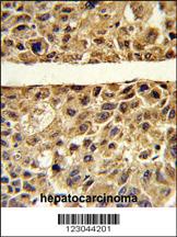 Anti-ARG1 Rabbit Polyclonal Antibody