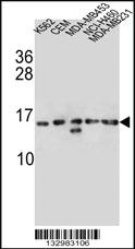 Anti-HIST1H2AB Rabbit Polyclonal Antibody