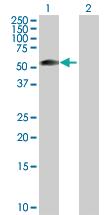 Anti-ZSCAN21 Rabbit Polyclonal Antibody