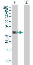 Anti-PVRIG Mouse Polyclonal Antibody