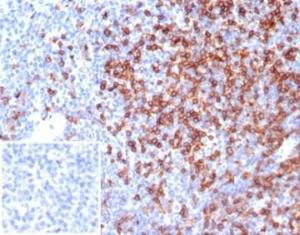 Immunohistochemical analysis of formalin-fixed, paraffin-embedded human tonsil tissue using Anti-CD4 Antibody [CD4/7142]. Inset: PBS instead of the primary antibody. Secondary antibody negative control