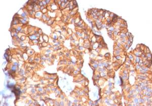 Anti-HER2 Mouse Monoclonal Antibody [clone: ERBB2/2452]