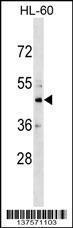 Anti-CHST10 Rabbit Polyclonal Antibody (HRP (Horseradish Peroxidase))