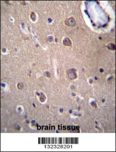 Anti-SLC8A3 Rabbit Polyclonal Antibody (Biotin)