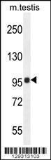 Anti-TMEM132E Rabbit Polyclonal Antibody (AP (Alkaline Phosphatase))